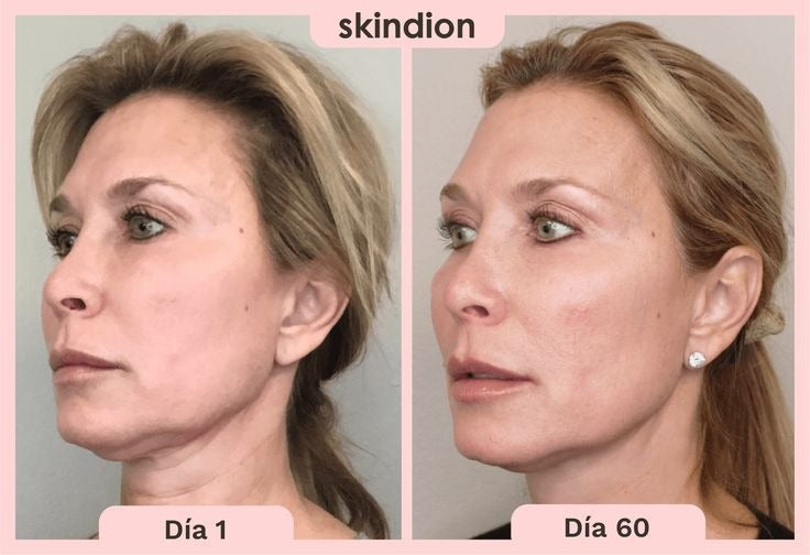 Skindion Masajeador Tonificador Facial